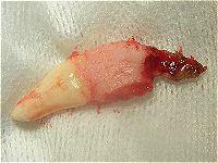 canine tooth removed showing rotten root