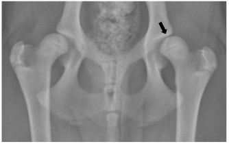 Radiograph of hip dysplasia in a dog