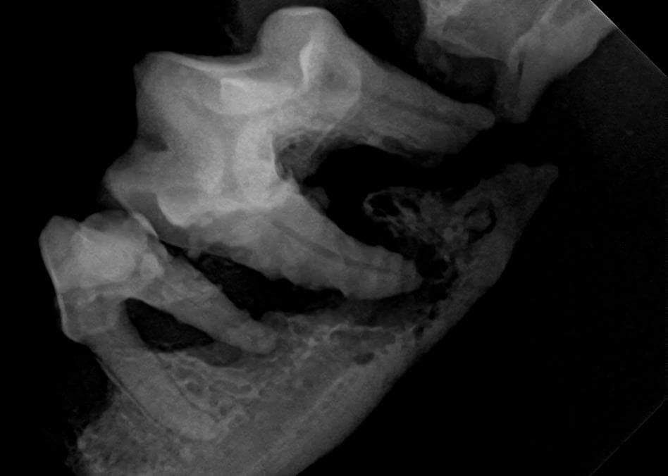 radiograph showing bone resorption with a fracture line