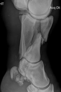 horse pastern fracture